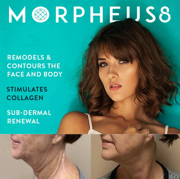 Morpheus8 Microneedling Fractional Treatment