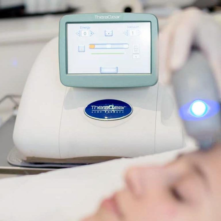 TheraClear Facial & Acne Laser Treatment