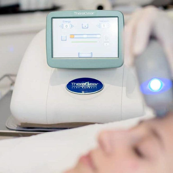 Three Theraclear Facial & Acne Treatments (PRICED FOR FOR FIRST TIME CLIENTS ONLY)